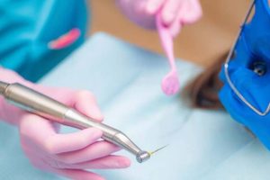 دستگاه روتاری دندانپزشکی چیست؟